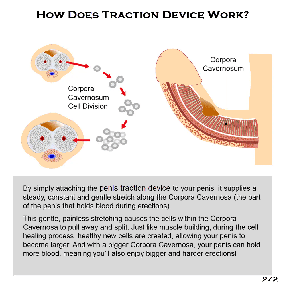 How does traction device work (2)