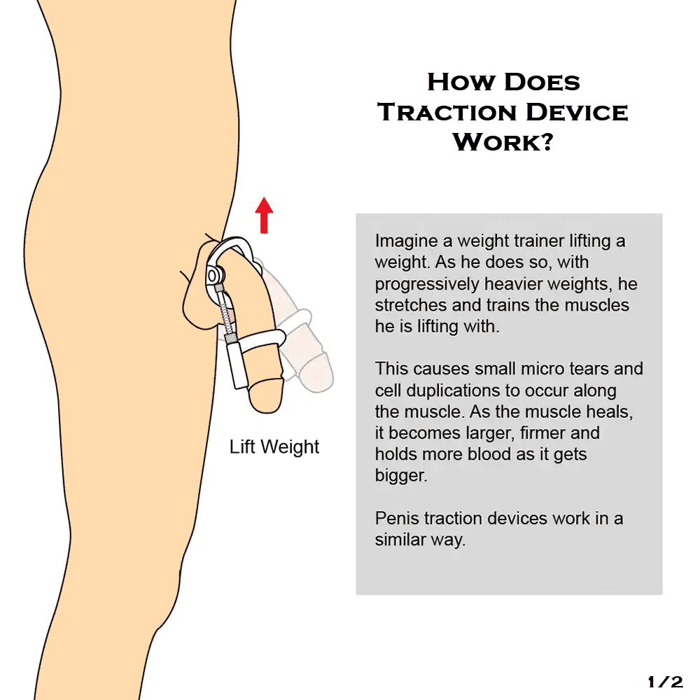 How does traction device work